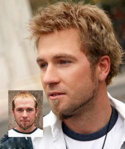 mens hair loss replacement new orleans kenner la