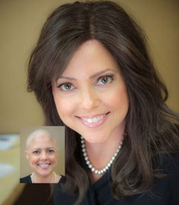 womens hair loss replacement systems new orleans